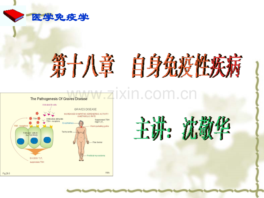 自身免疫性疾病.pptx_第1页