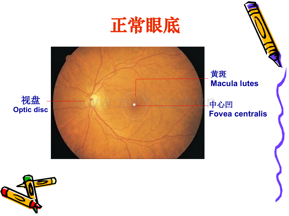 糖尿病视网膜病变科内讲座.pptx_第3页