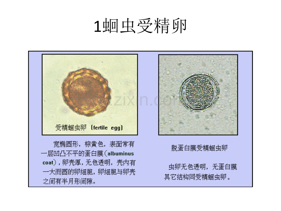 温医医本寄生虫实验考复习资料.pptx_第1页