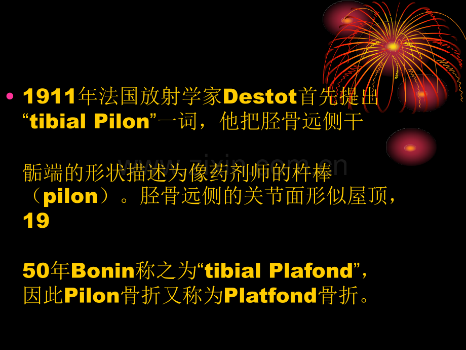 Pilon骨折的概念.pptx_第2页