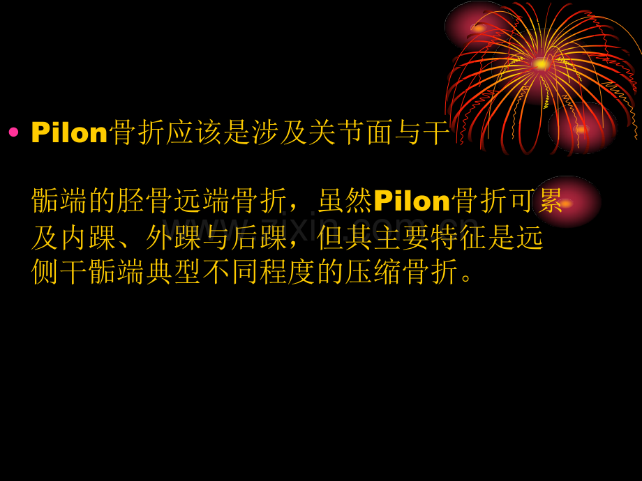 Pilon骨折的概念.pptx_第3页