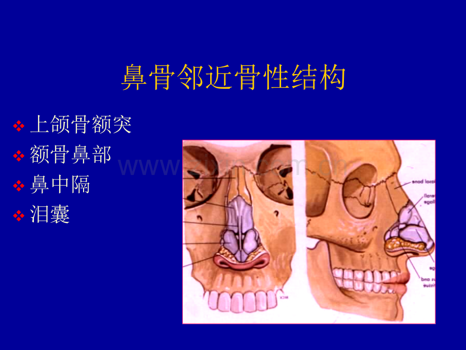 鼻骨骨折的影像诊断.pptx_第3页