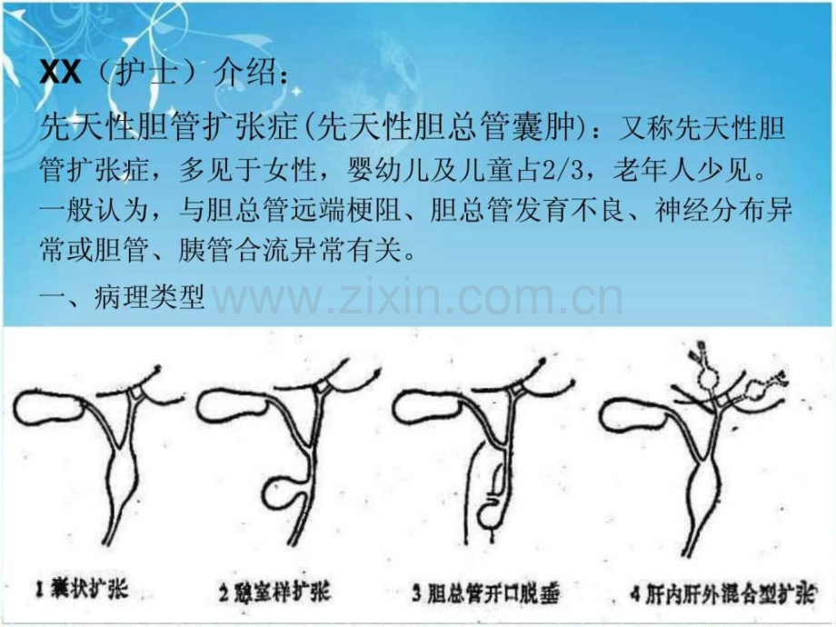 先天性胆总管囊肿护理查房.pptx_第3页