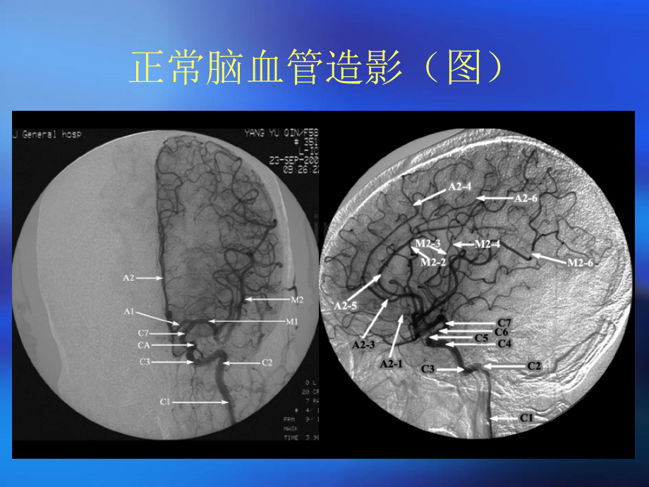 颅骨x线诊断.pptx_第1页