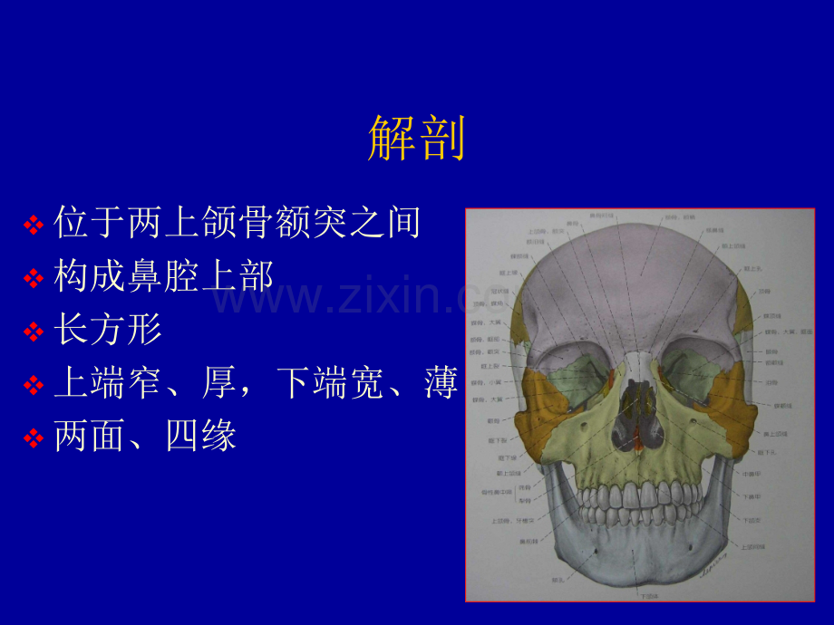 鼻骨骨折影像学诊断.pptx_第2页