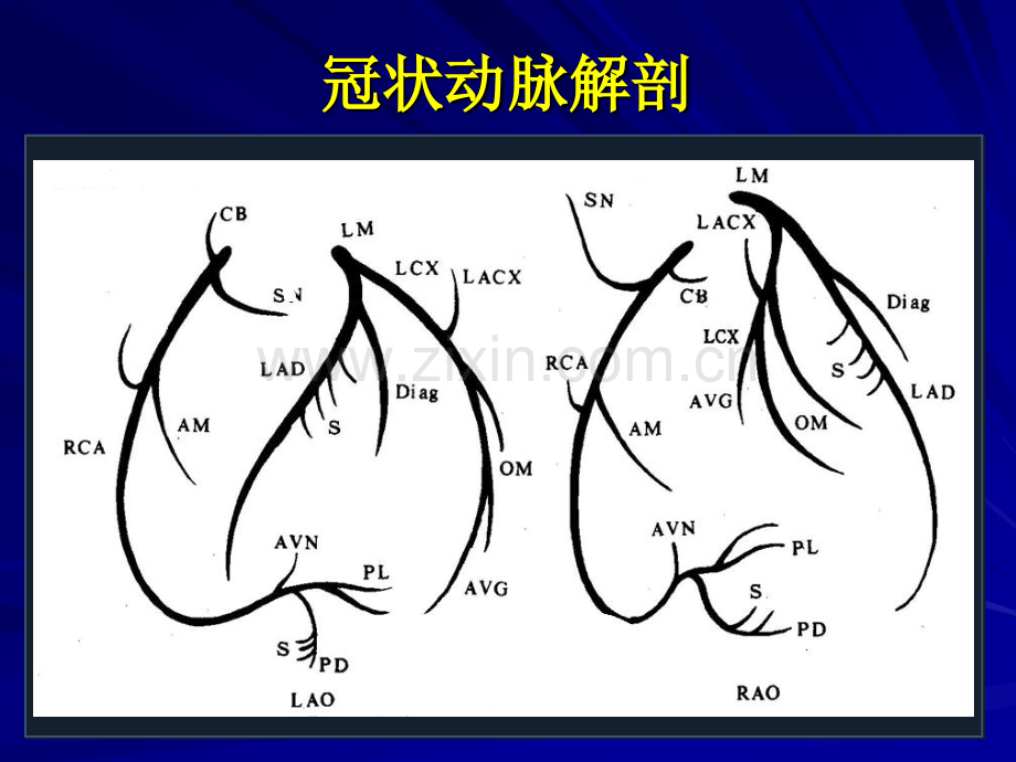 冠状动脉造影的正确判读.pptx_第3页