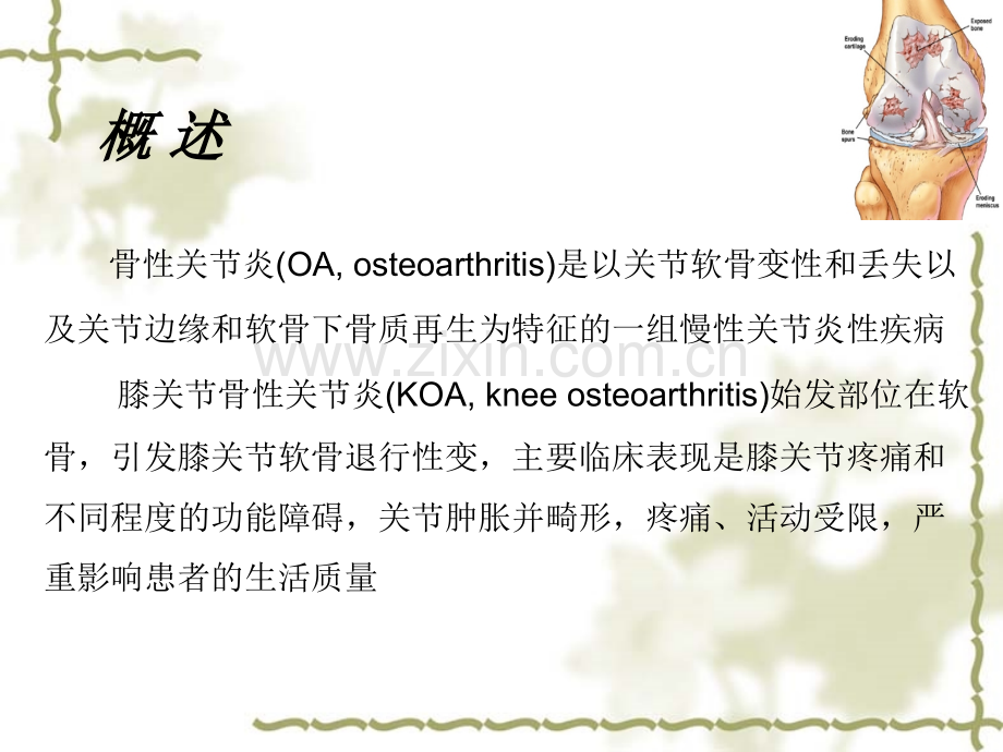 KOA治疗新观点.pptx_第2页