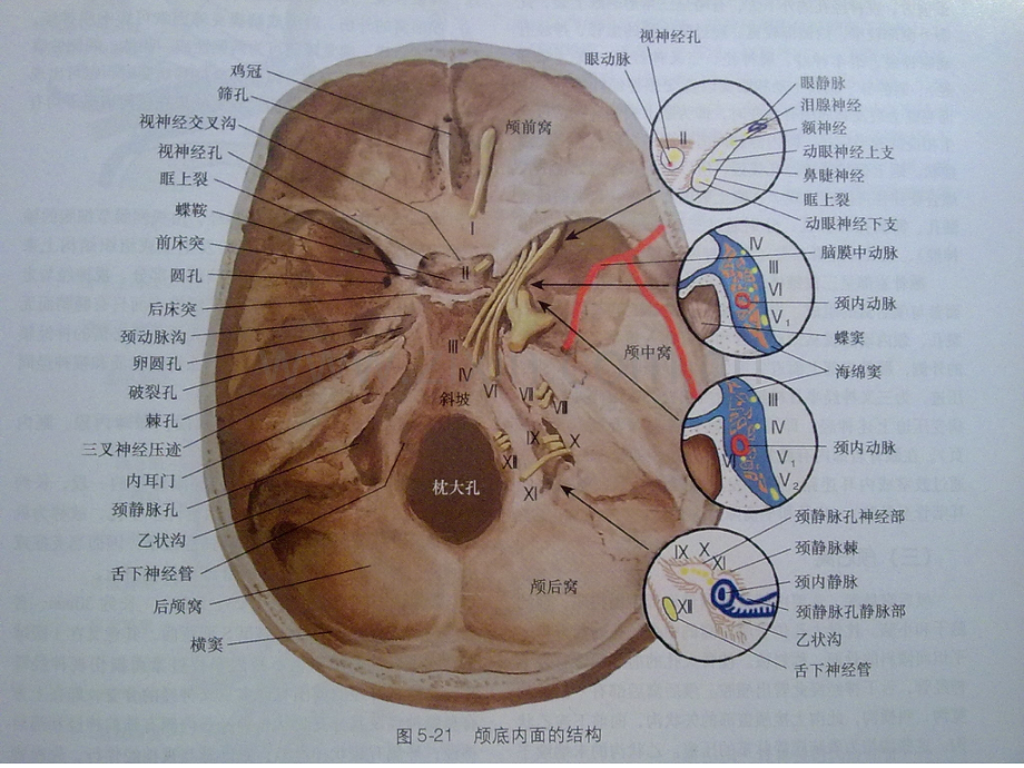 颅底肿瘤.pptx_第3页