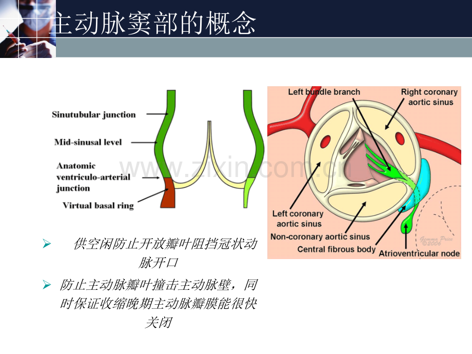 主动脉窦动脉瘤Valsalva窦动脉瘤.pptx_第3页