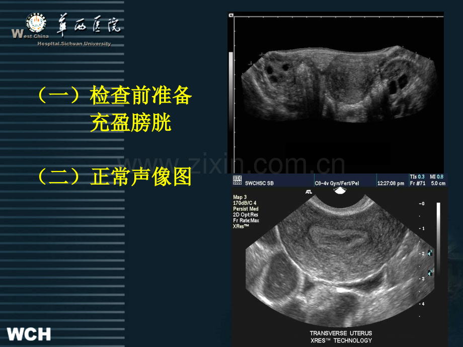 产前超声诊断妇产科及心脏超声2新.pptx_第3页