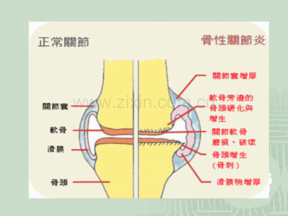 B负重直腿抬高练习.pptx_第3页