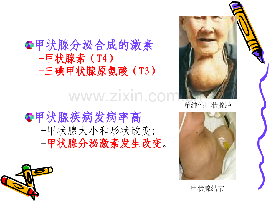 《药理学》课件第31章--甲状腺激素及抗甲状腺激素药.ppt_第3页