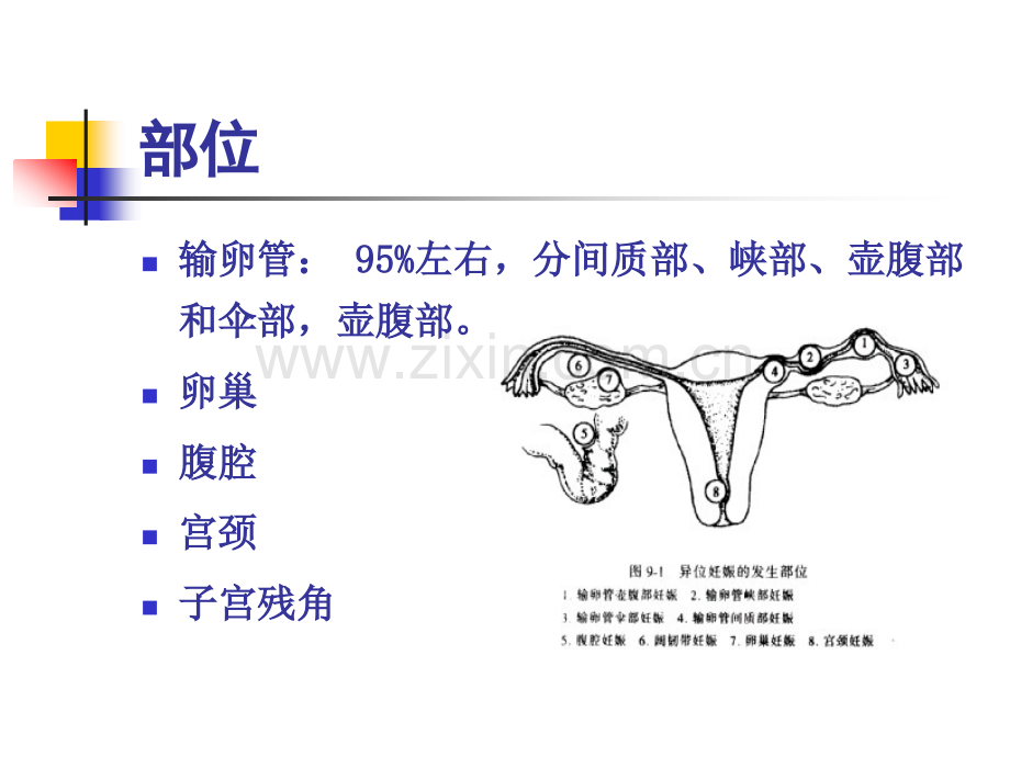 《妇产科护理学》PPT教程课件-第7章-妊娠期并发症妇女的护理.pptx_第3页