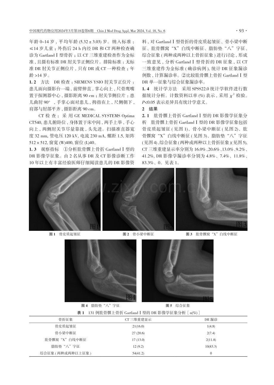 肱骨髁上骨折GartlandⅠ型的DR影像学分析.pdf_第2页