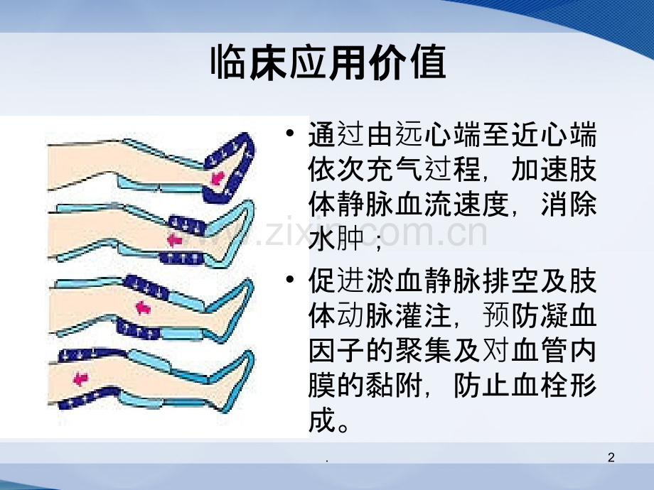 气压治疗仪的使用课件.ppt_第2页