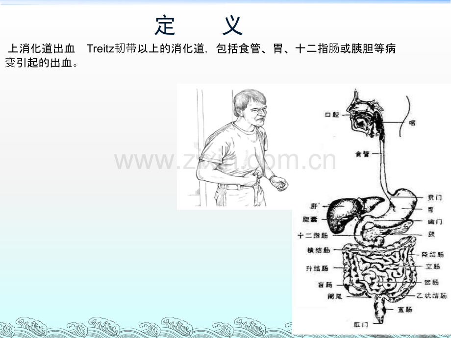 消化道出血的诊治ppt课件.ppt_第2页