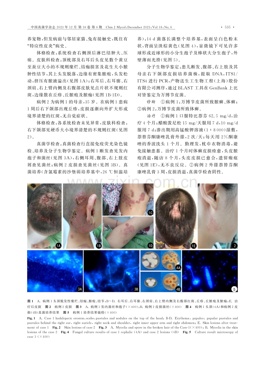 母女二人共患万博节皮菌所致皮肤癣菌病.pdf_第2页