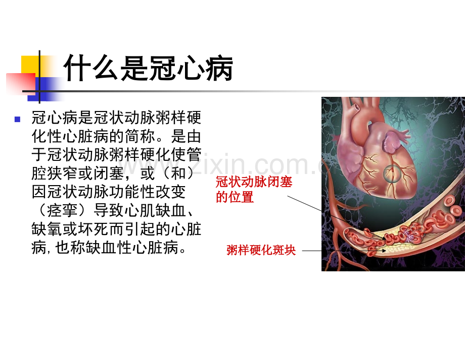 河南科技大学第一附属医院心内科.pptx_第2页