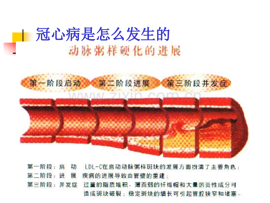 河南科技大学第一附属医院心内科.pptx_第3页