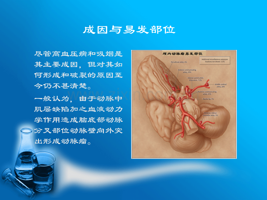 珠网膜下腔出血与动脉瘤.pptx_第3页