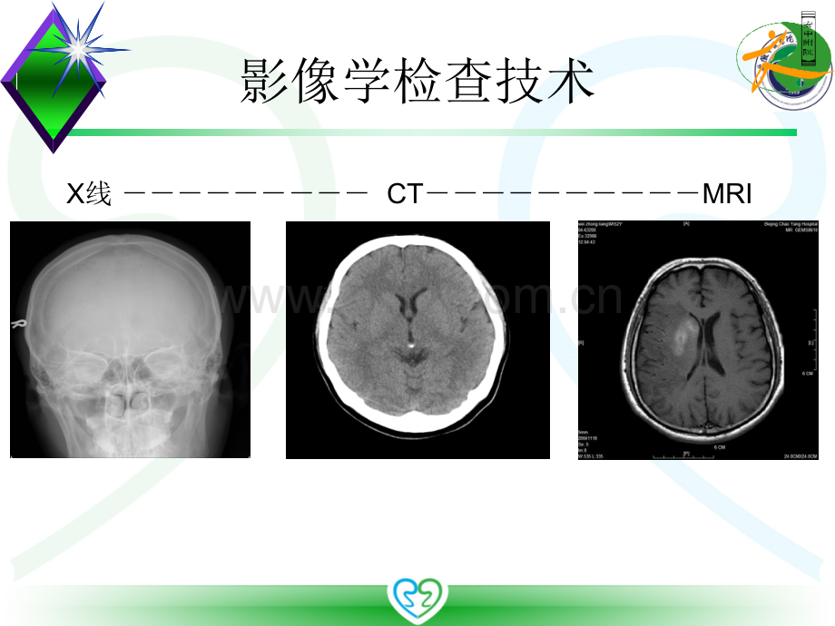 课件中枢神经系统影像诊断.pptx_第3页