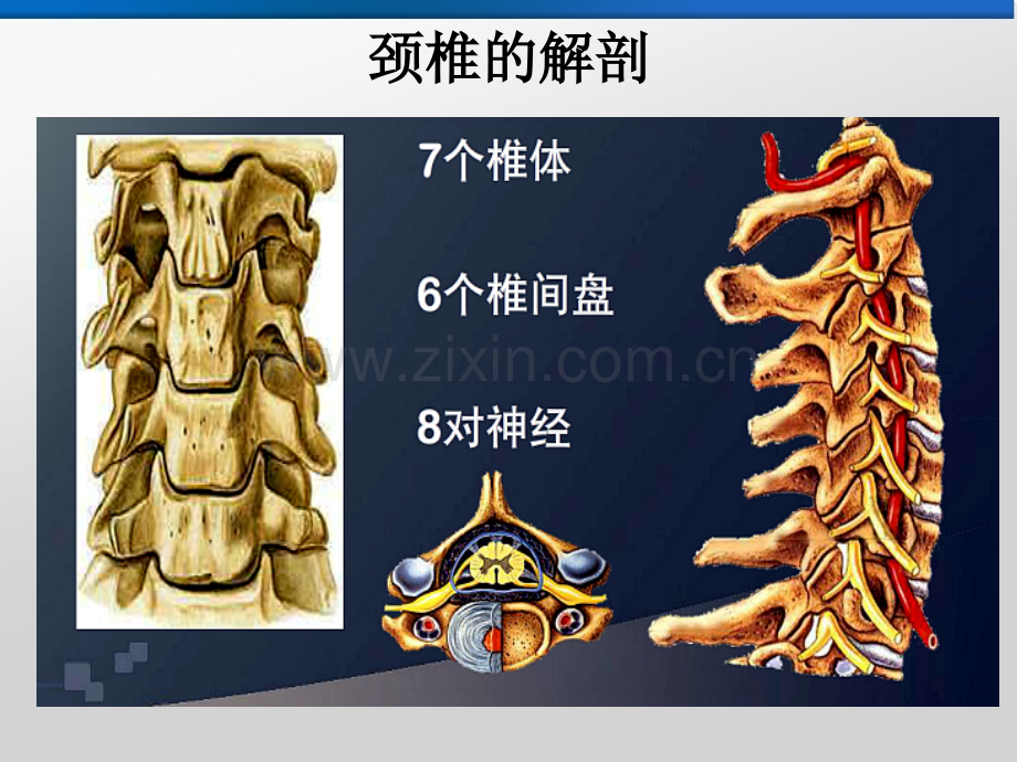 盘源性颈背及上肢疼痛.pptx_第3页