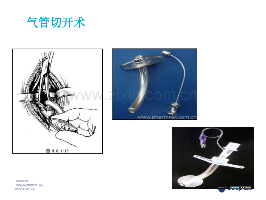 气切与引流管的护理课件.pptx_第3页