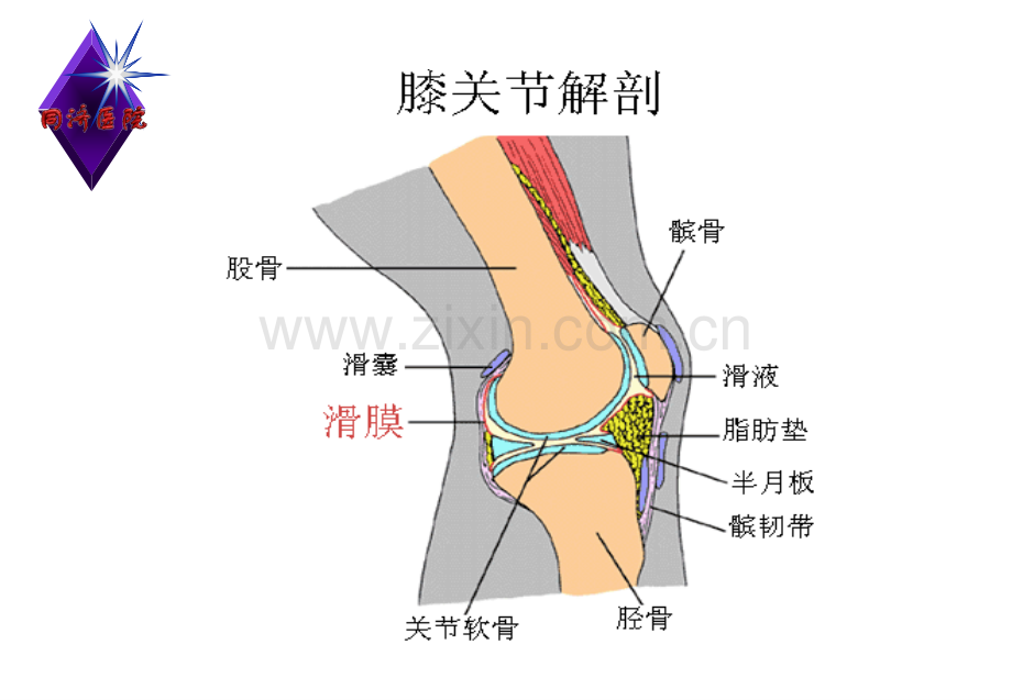 膝关节滑膜病变的MR诊断.pptx_第3页