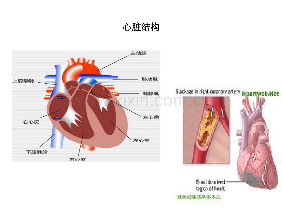 老年医学保健冠心病.pptx_第2页