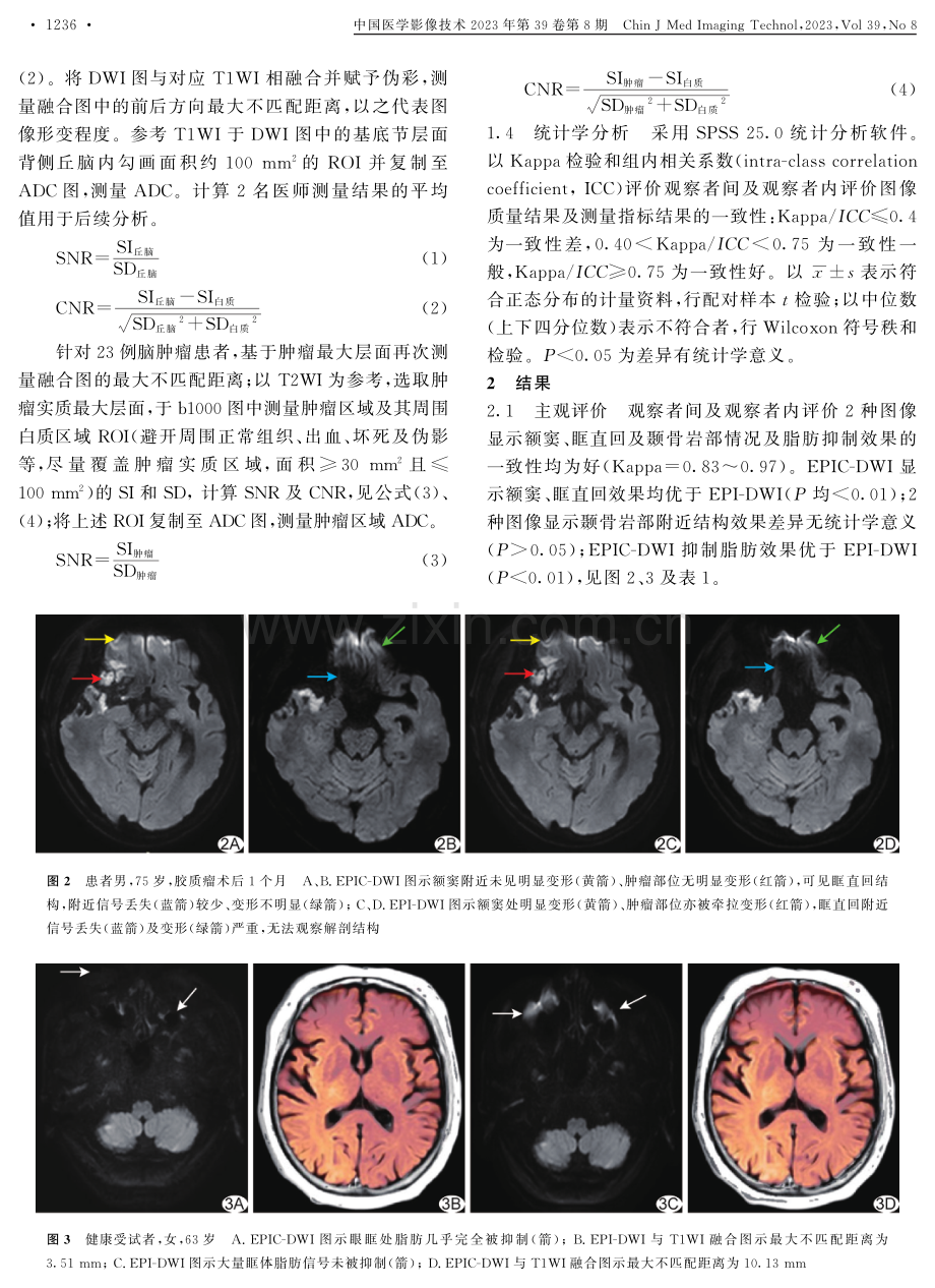 几何校正平面回波成像用于改进颅脑弥散加权成像质量.pdf_第3页