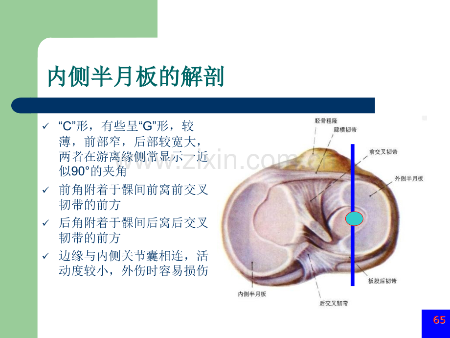 膝关节半月板损伤MRI诊断ppt.pptx_第2页