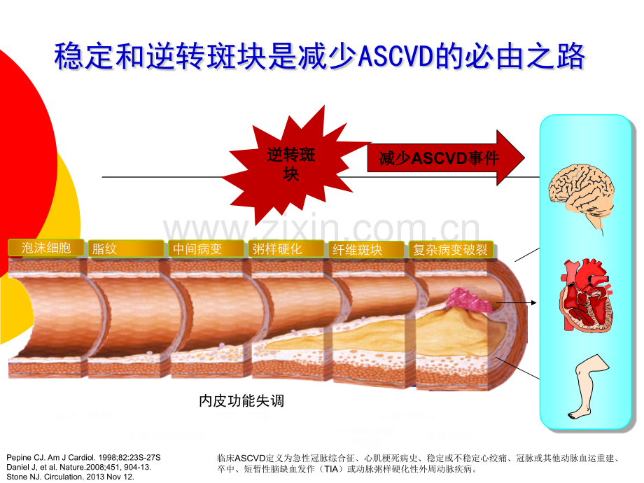 调脂治疗逆转冠斑块.pptx_第3页