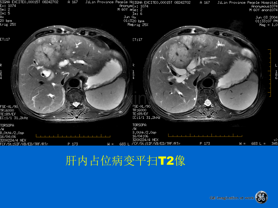 腹部扫描脉冲序列.pptx_第2页