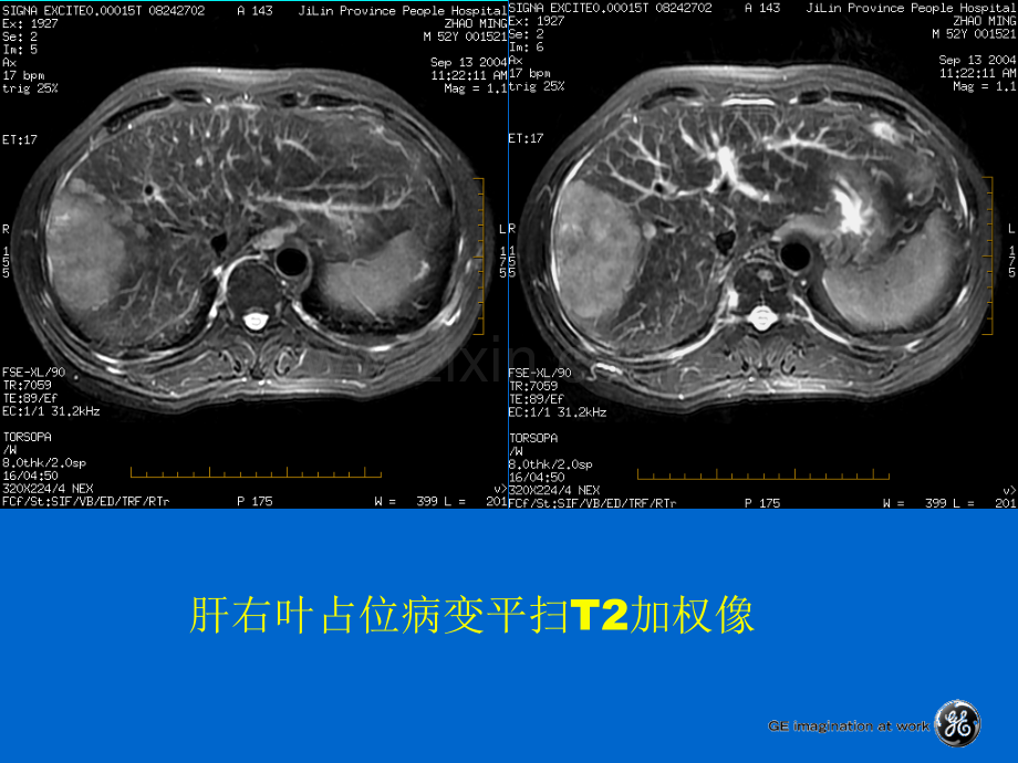 腹部扫描脉冲序列.pptx_第3页