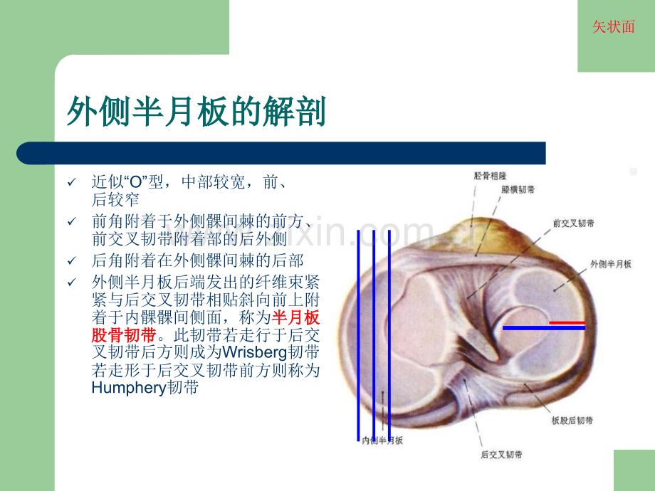 膝关节半月板损伤MRI诊断.pptx_第3页