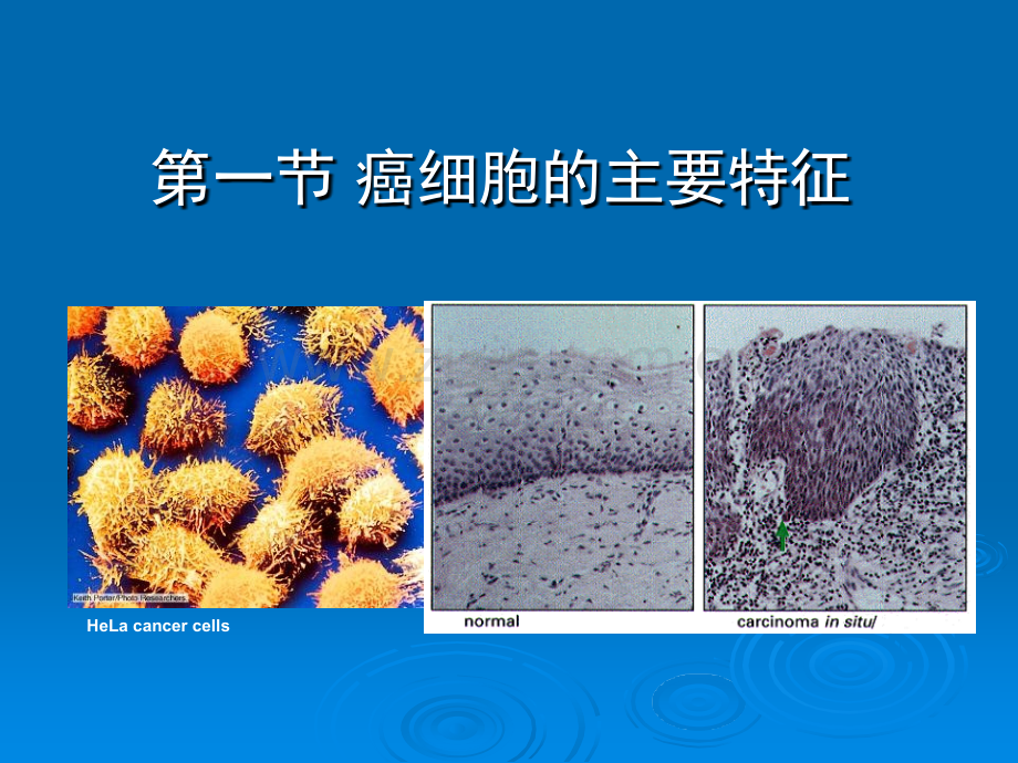 细胞生物学教程肿瘤细胞.pptx_第3页