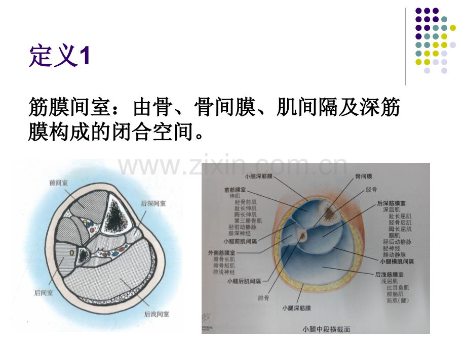 筋膜间室综合征.pptx_第2页