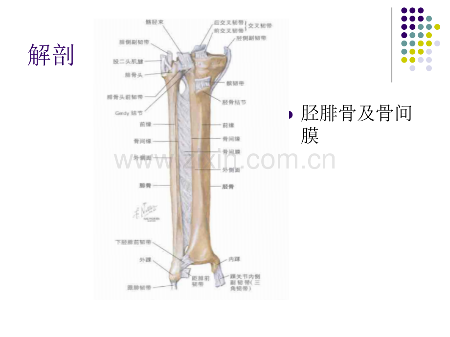 筋膜间室综合征.pptx_第3页