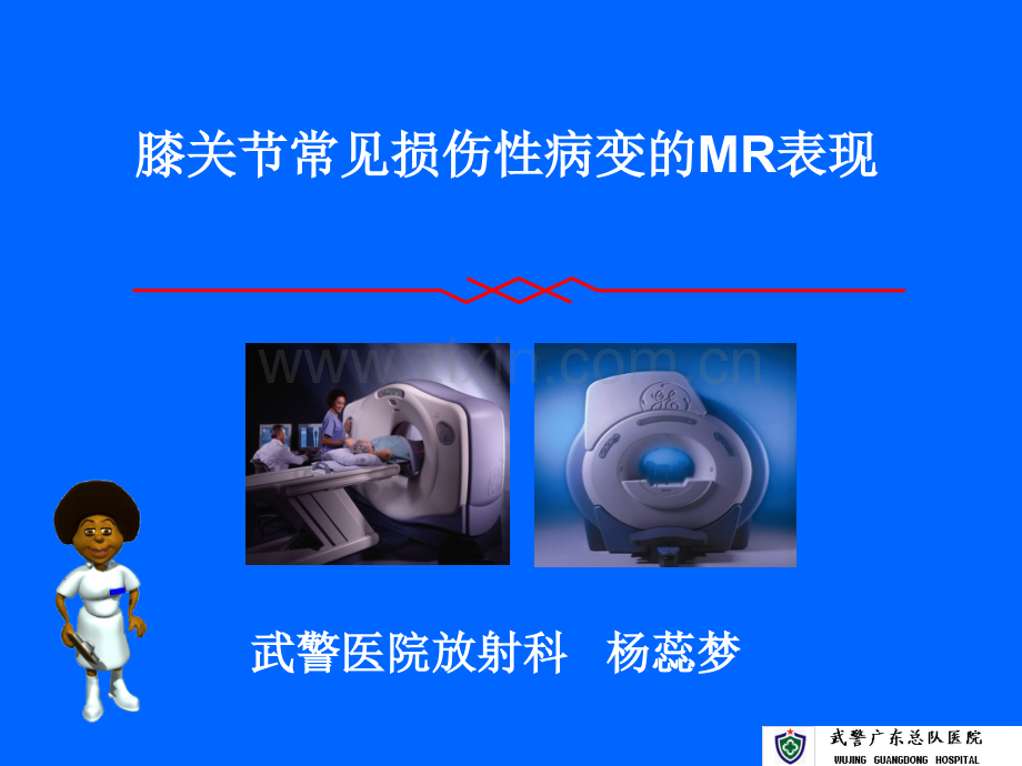 膝关节常见损伤性病变的MR表现.pptx_第2页