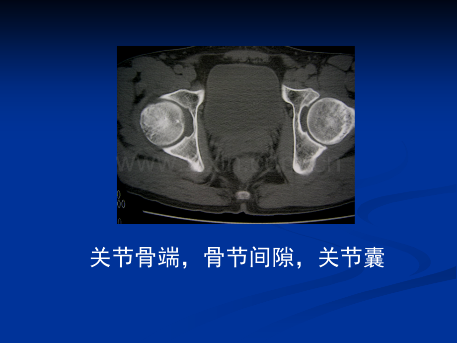 检查技术影像观察与分析.pptx_第2页