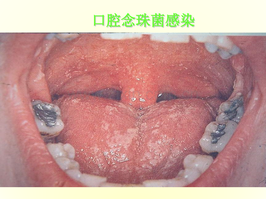 艾滋病专业.pptx_第2页