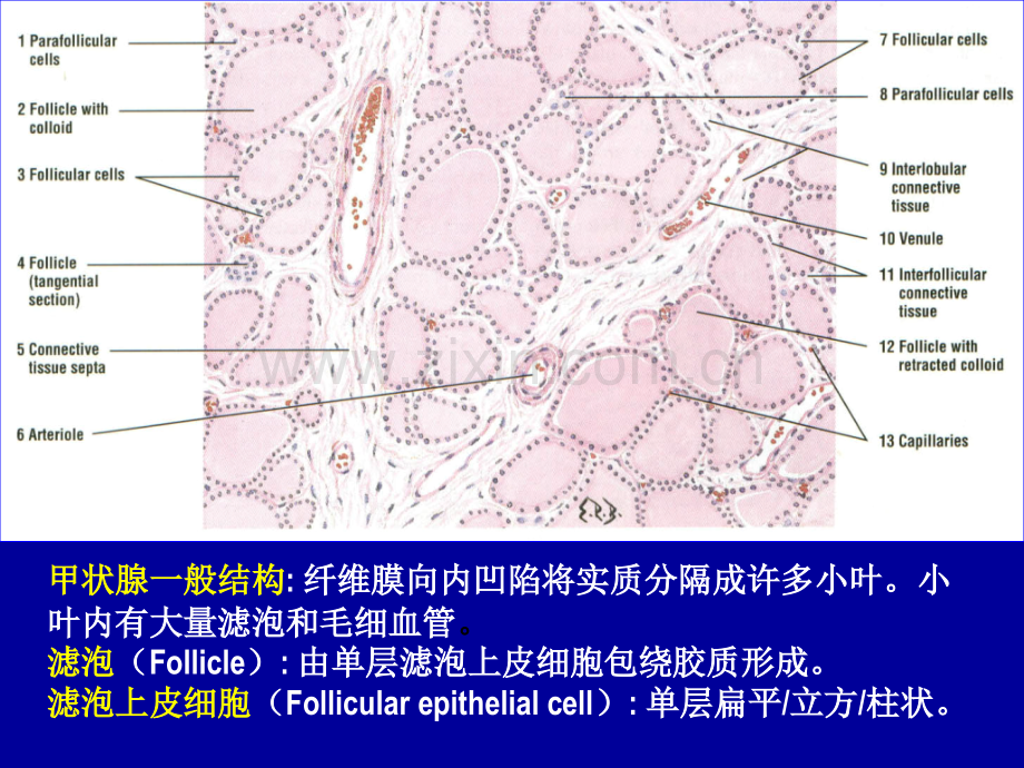 研究生入学考试病理学内分泌系统疾病.pptx_第3页