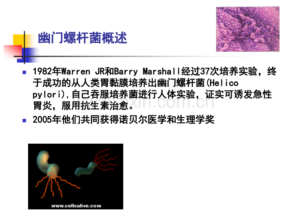 认识幽门螺杆菌.pptx_第3页