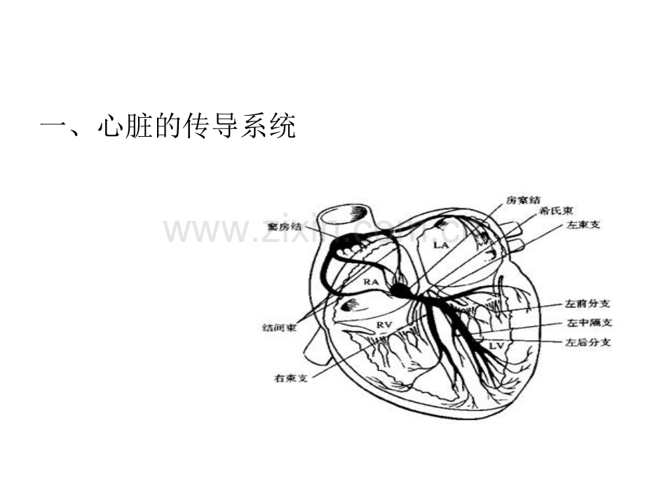 束支传导阻滞病人围麻醉期处理策略.pptx_第3页