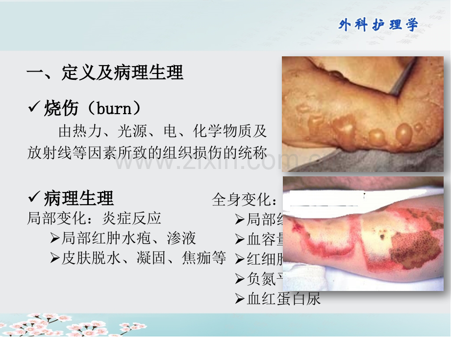 烧伤的预防与护理.pptx_第3页