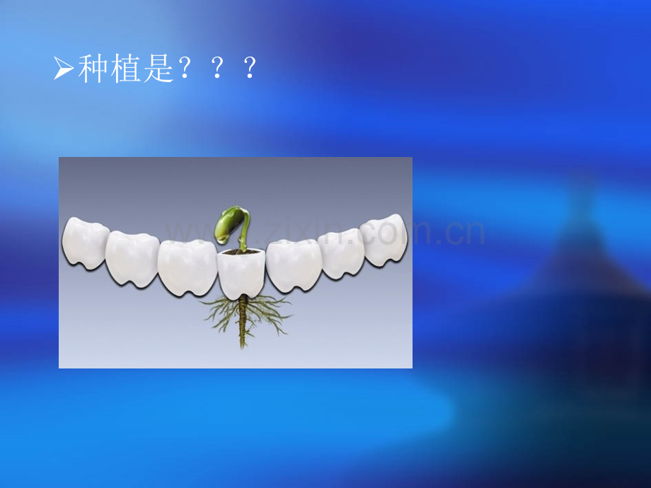 种植学概论.pptx_第2页