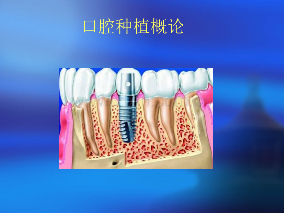 种植学概论.pptx_第3页