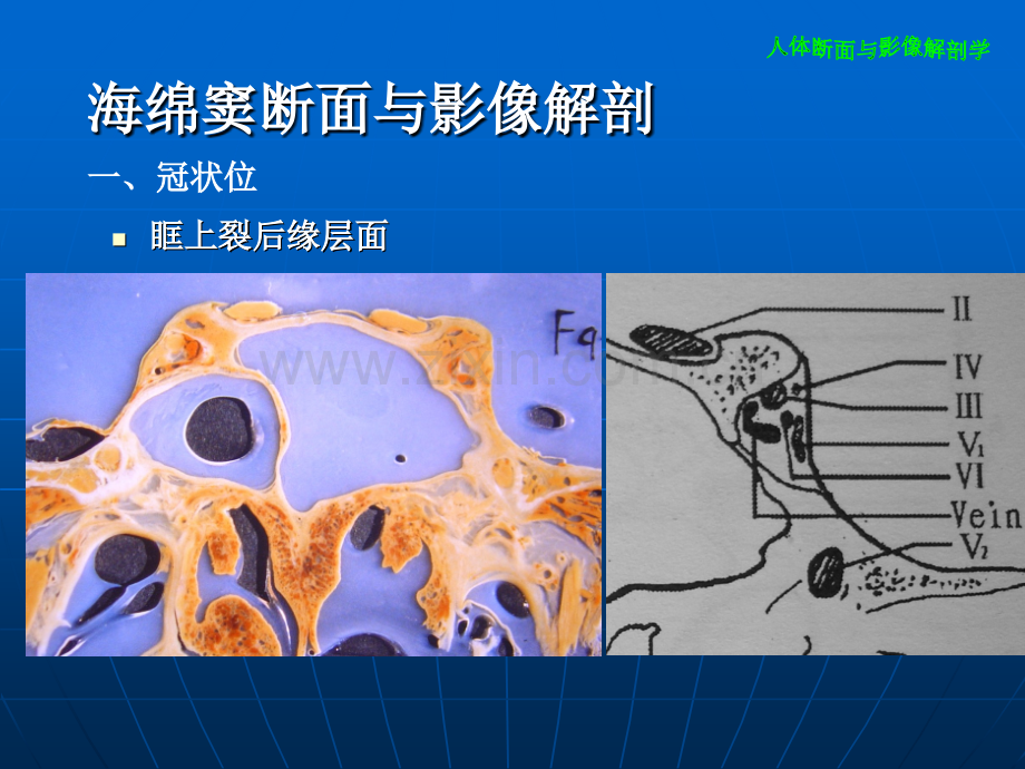 海绵窦断面与影像解剖.pptx_第1页