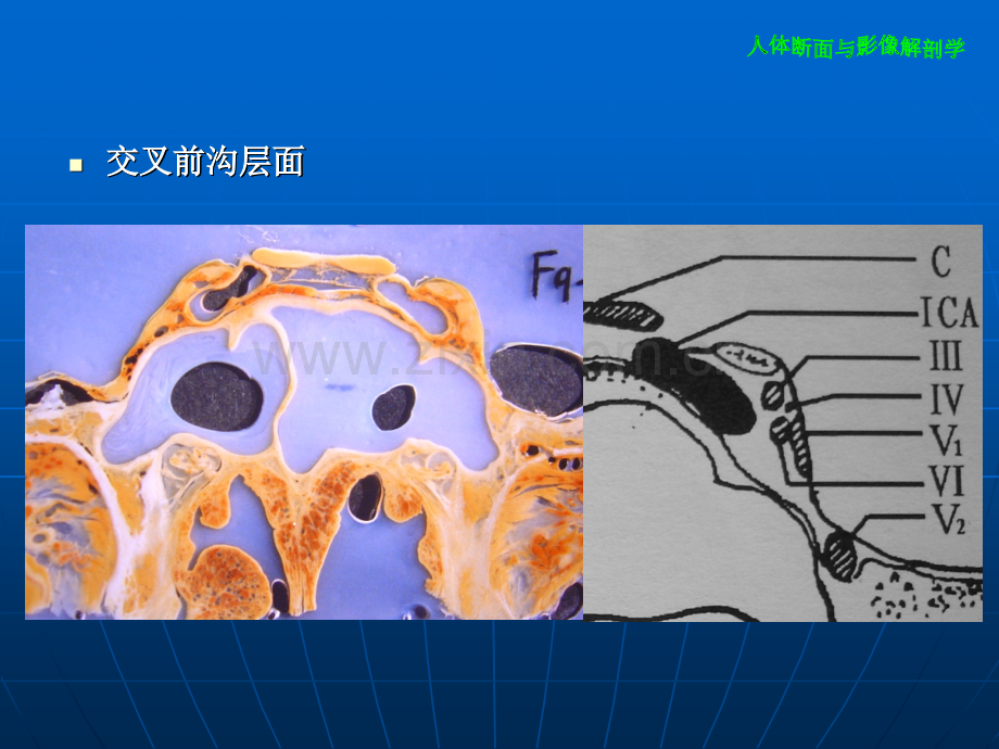 海绵窦断面与影像解剖.pptx_第3页