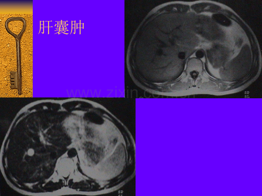 腹部疾病的MR诊断.pptx_第2页